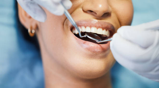 Best Urgent Care for Lost Fillings or Crowns in Velva, ND